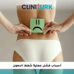 أسباب فشل عملية شفط الدهون