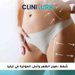 شفط دهون الظهر وأعلى المؤخرة في تركيا