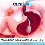 ما هي أضرار بالون المعدة وكيفية التعامل معها؟