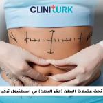 نحت عضلات البطن (حفر البطن) في اسطنبول تركيا
